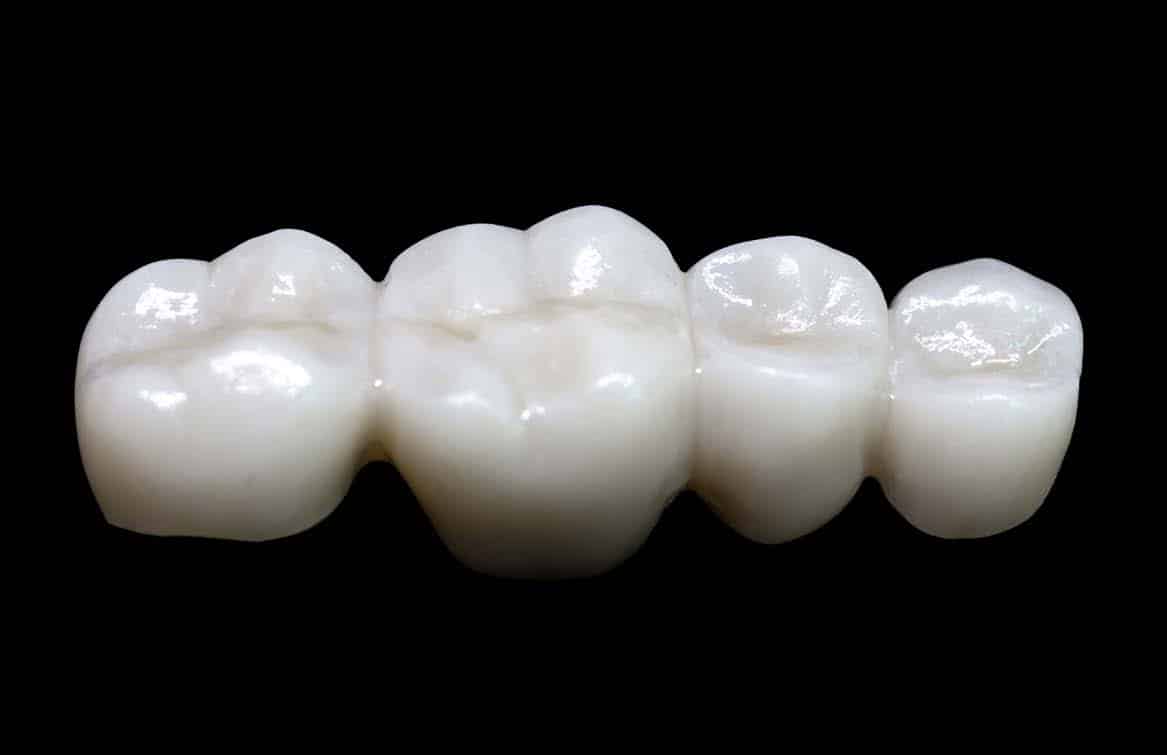 Everything you need to know about dental zirconia