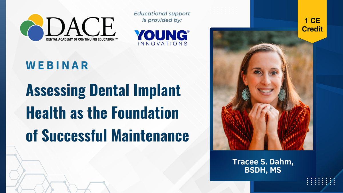 dental implant
