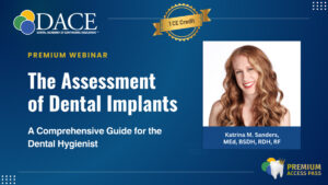 dental implants
