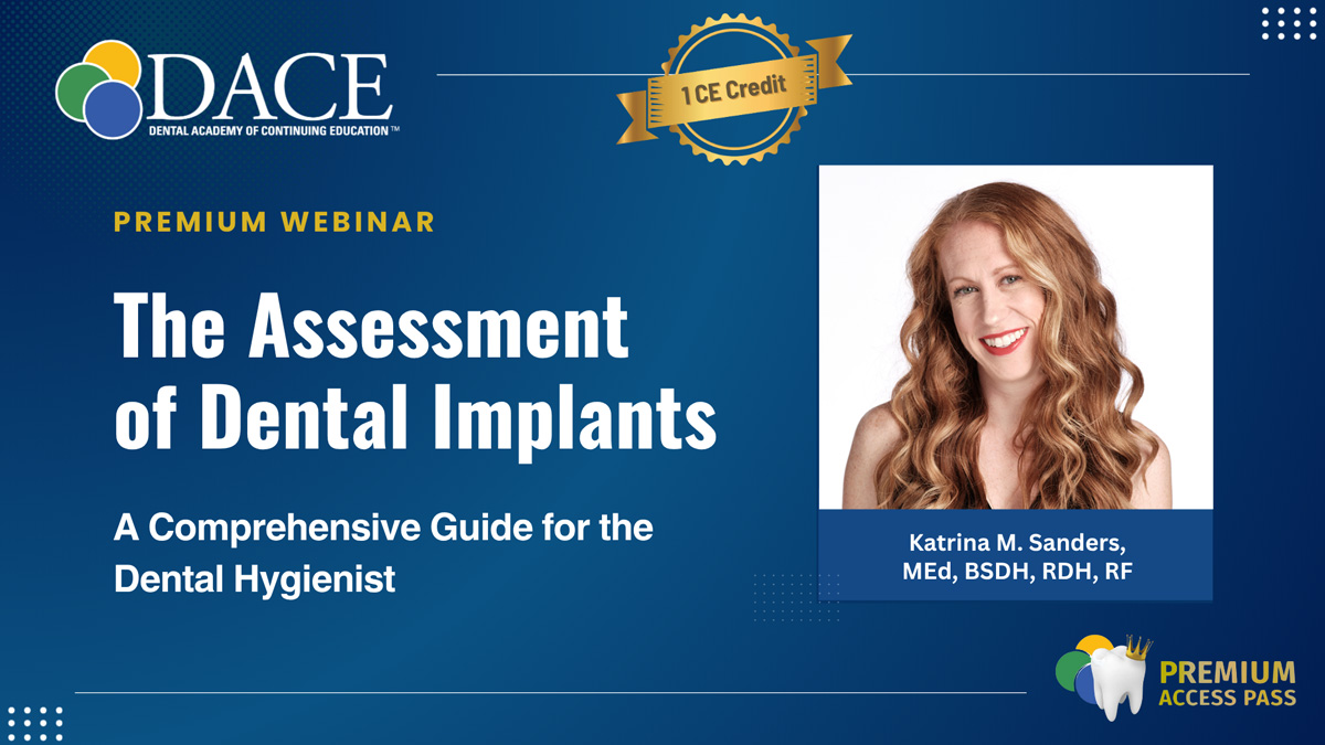 dental implants