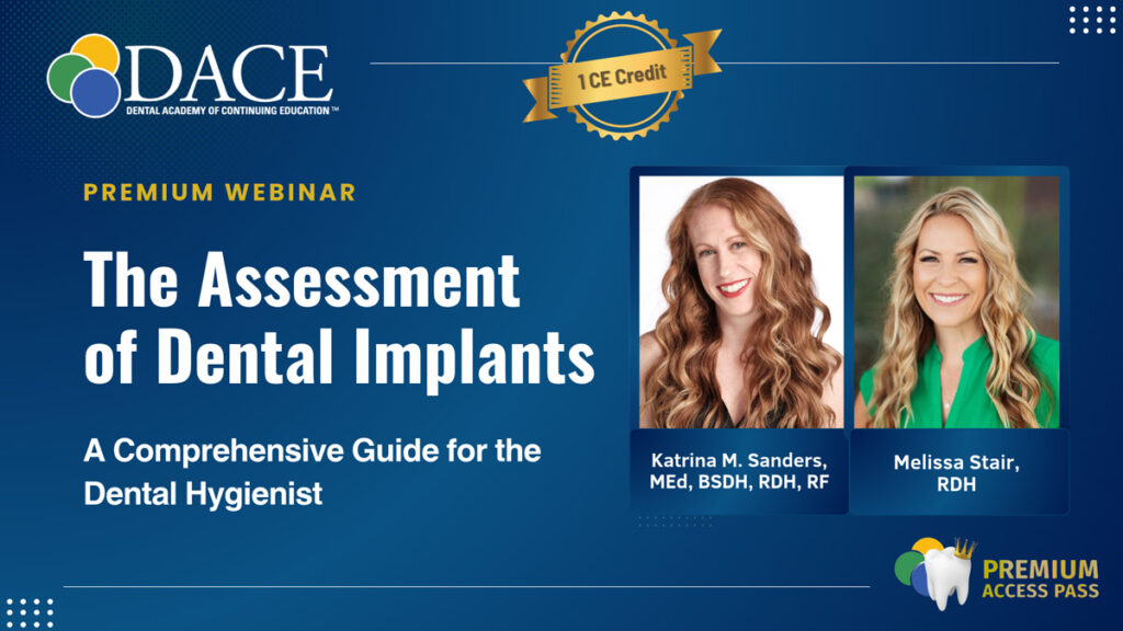 dental implants